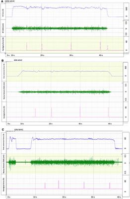 Temporal perception is distorted by submaximal and maximal isometric contractions of the knee extensors in young healthy males and females